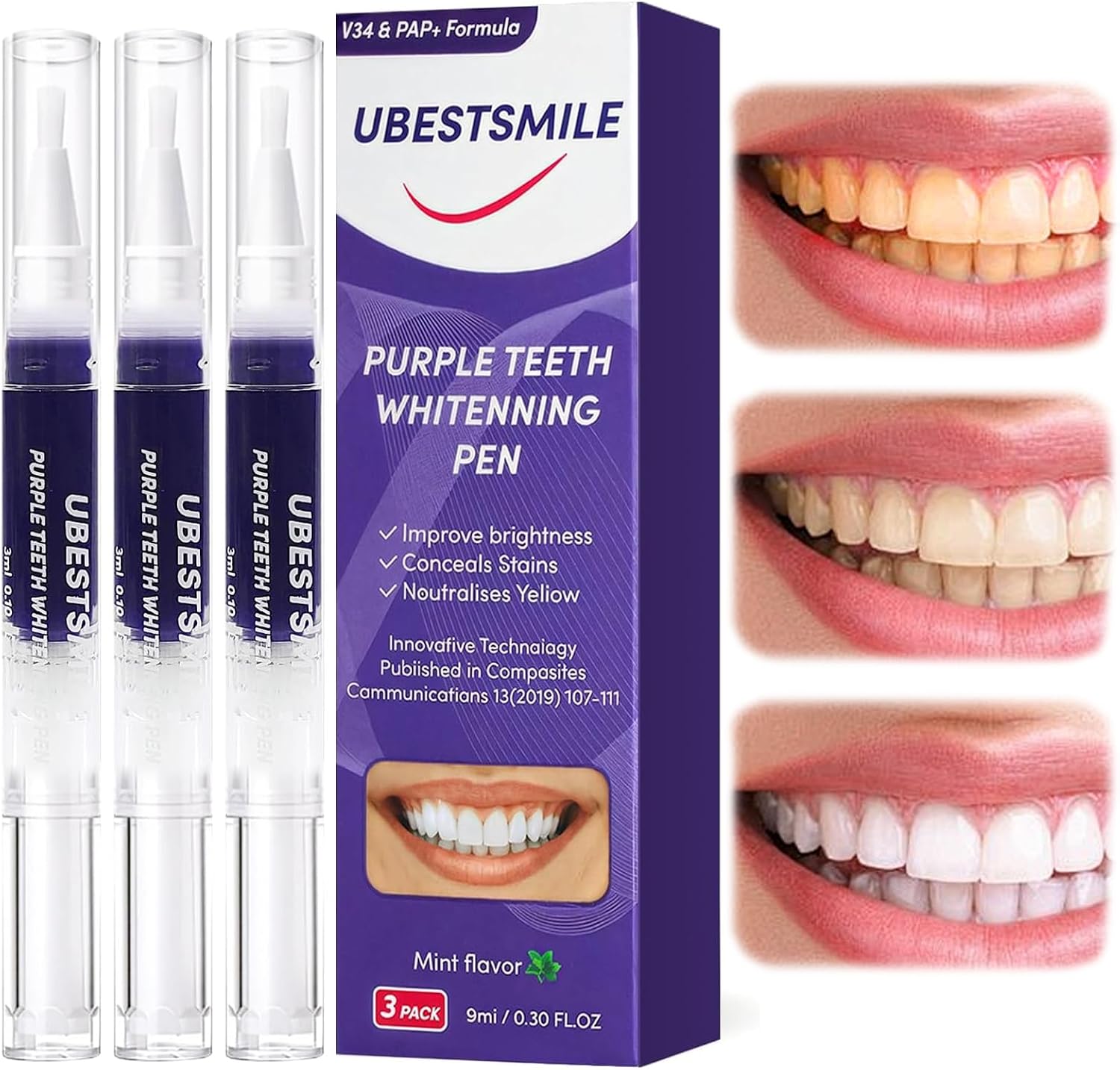 UBESTSMILE V34&PAP+ Fórmula Pu - Teeth Whitening Pens reseña y precio