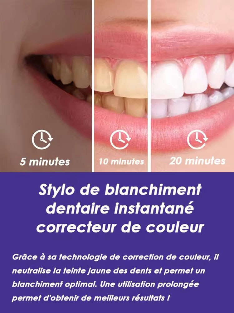 Set de 2 Bolígrafos Blanqueado - Teeth Whitening Pens reseña y precio