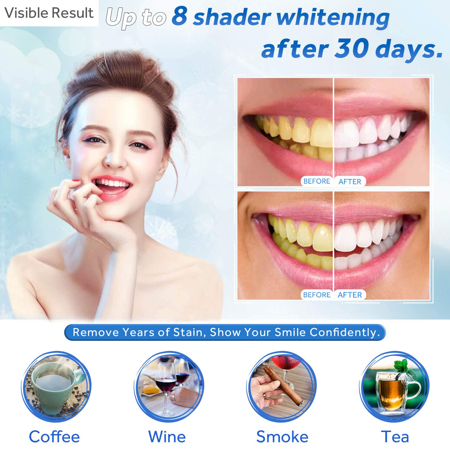 Jeringa de repuesto de Gel par - Teeth Whitening Kit reseña y precio