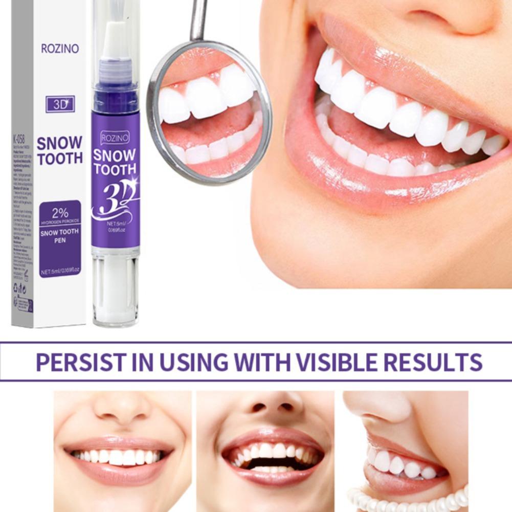 Lápiz portátil para blanquear  - Teeth Whitening Pens reseña y precio